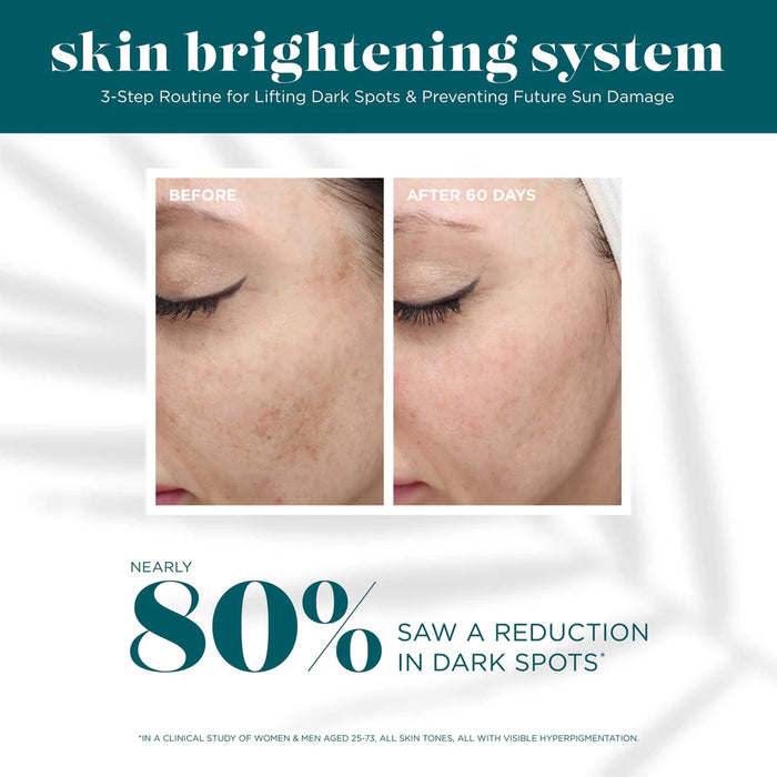 VI Skin Brightening System