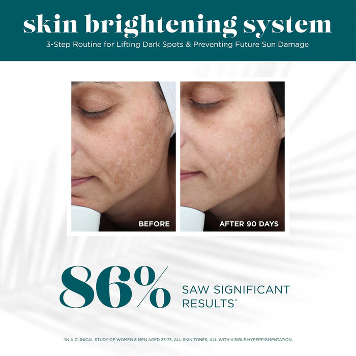 VI Skin Brightening System