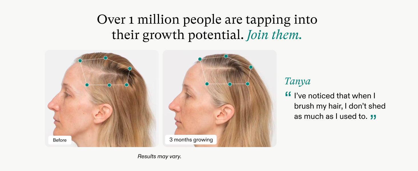 Nutrafol, compléments alimentaires végétaliens pour la croissance des cheveux chez les femmes