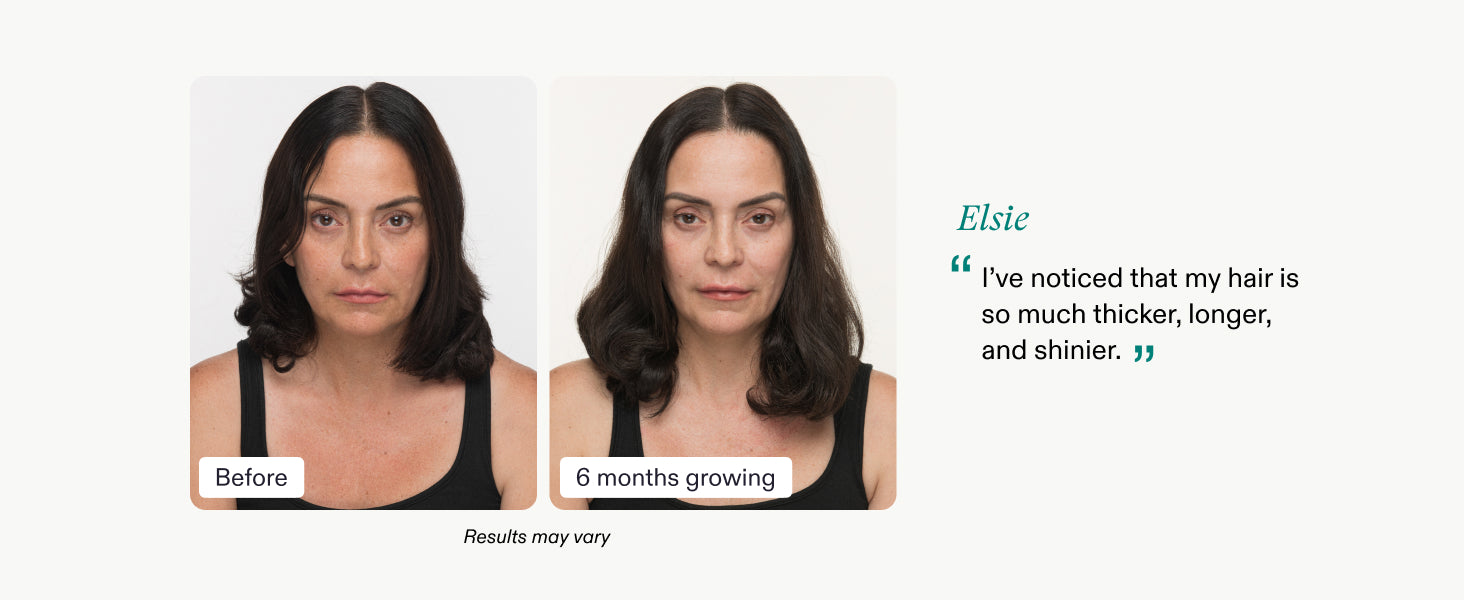 Nutrafol Women's Balance Hair Growth Supplements