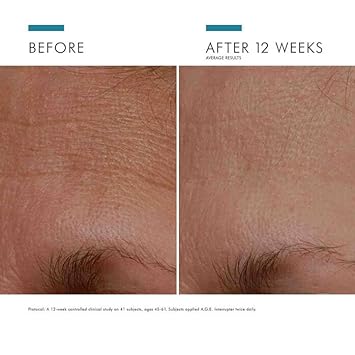 SkinCeuticals A.G.E. Interrupter Advanced