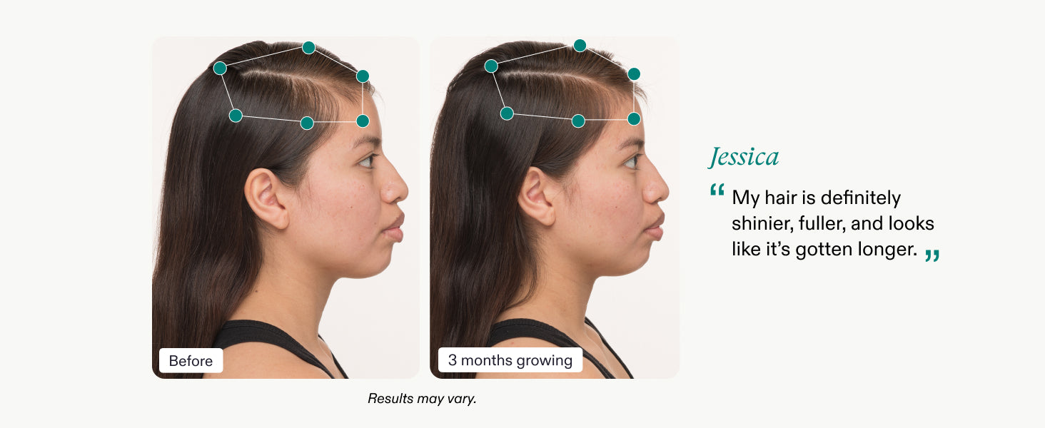 Nutrafol Postpartum Hair Growth Supplements