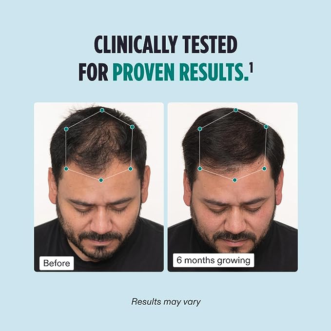 Nutrafol Men's Hair Growth Supplements