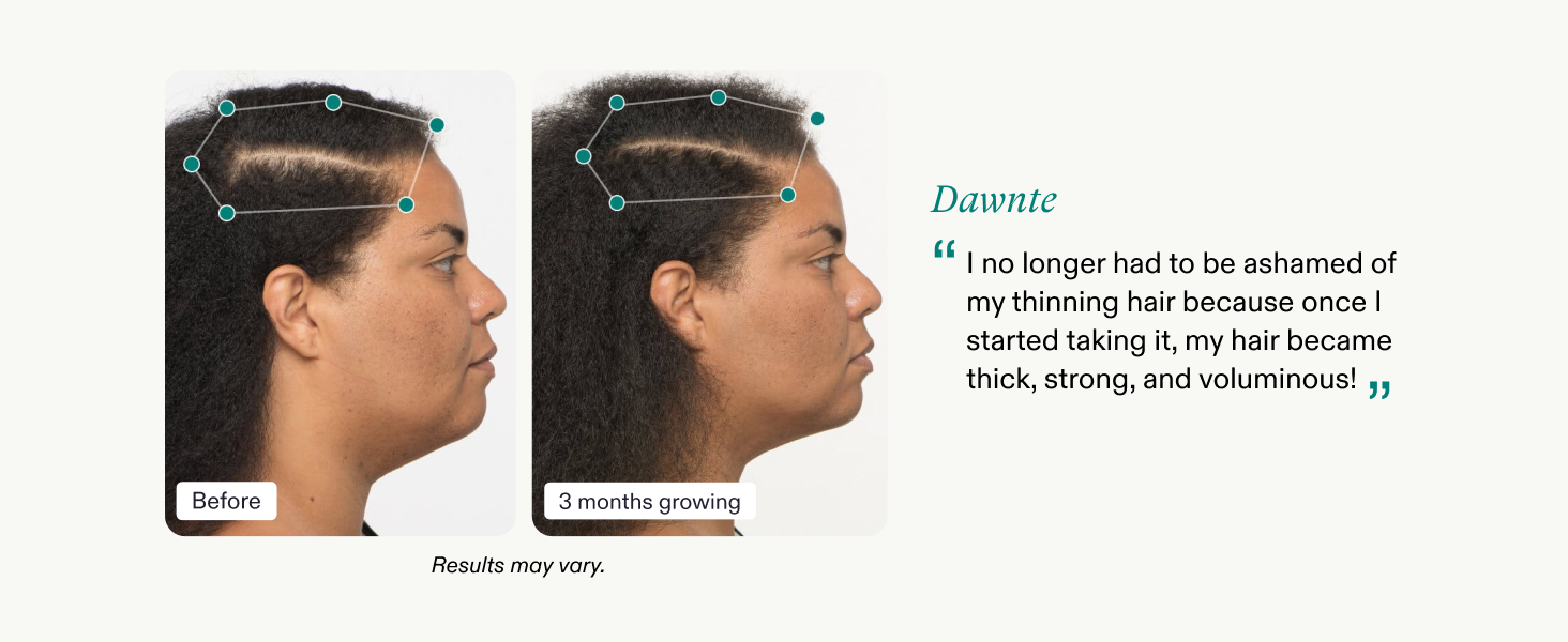 Nutrafol Women's Hair Growth Supplements