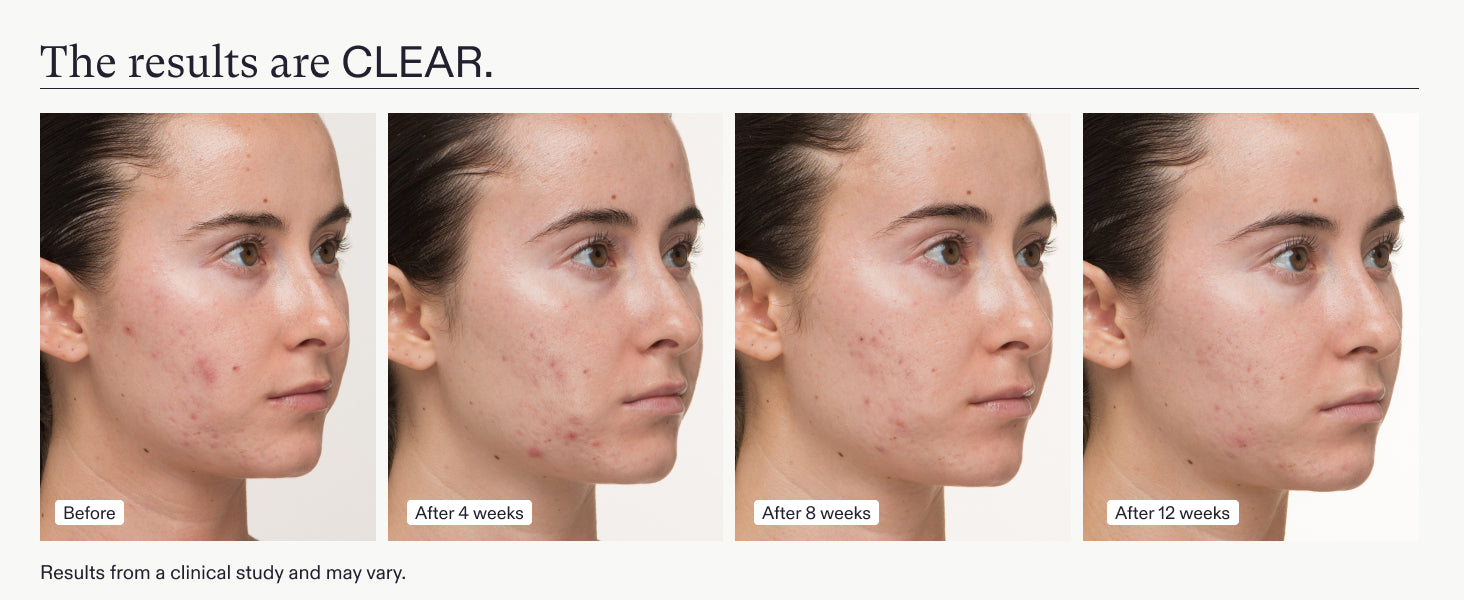 Nutrafol Skin Clear Skin ProPack (3-Month Supply)