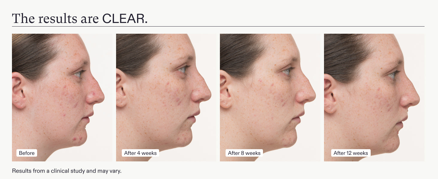 Compléments alimentaires Nutrafol Skin Clear Skin