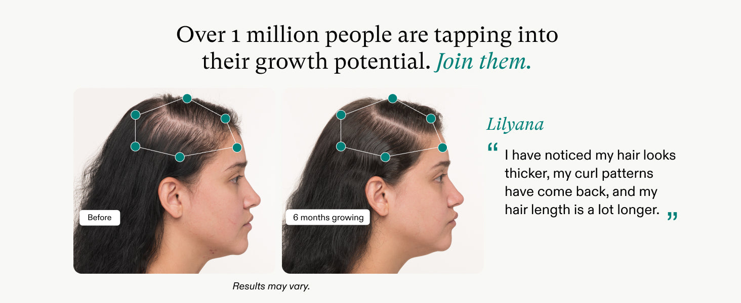 Nutrafol Postpartum Hair Growth Supplements