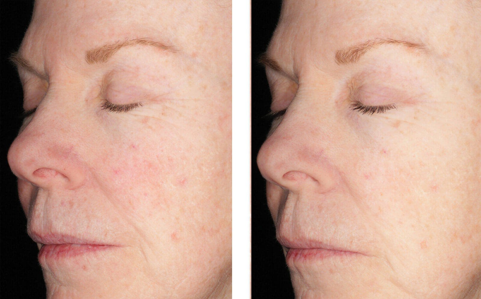 SkinBetter Science Alto Defense Serum