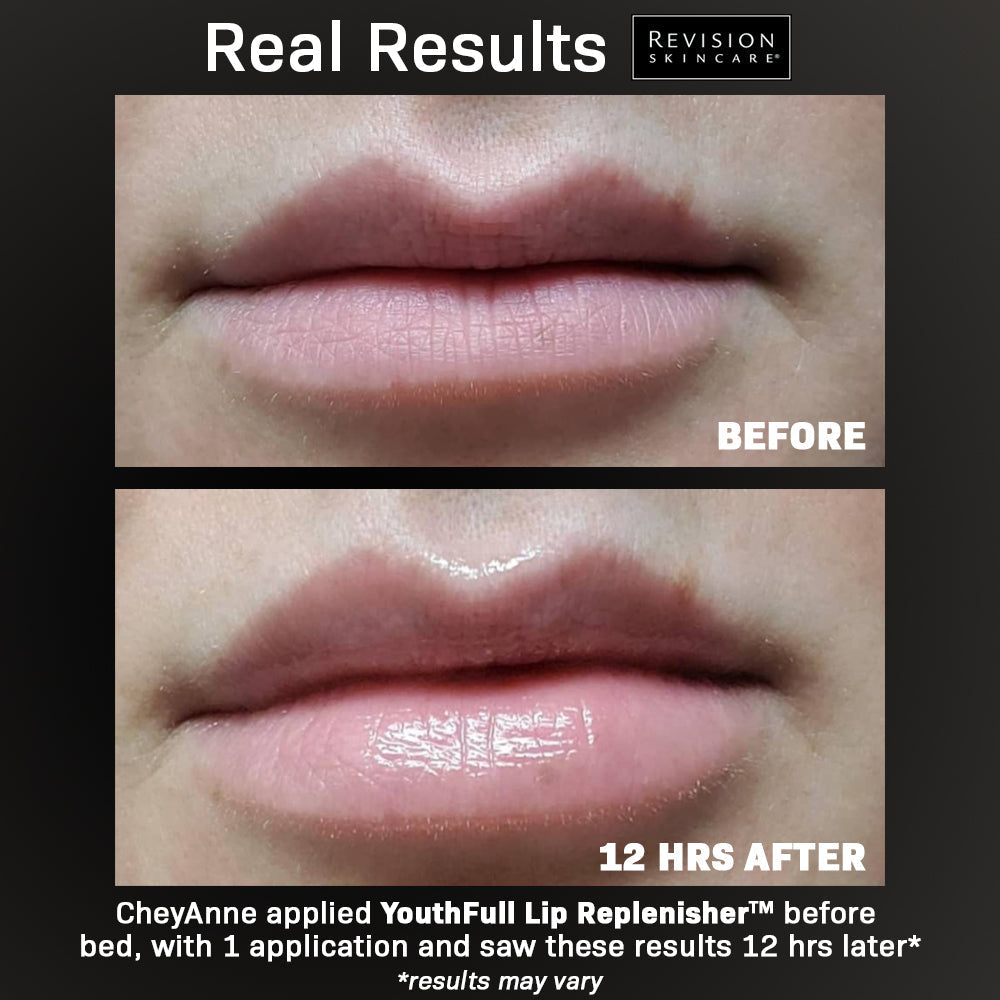 Revision Skincare Youthful Lip Replenisher