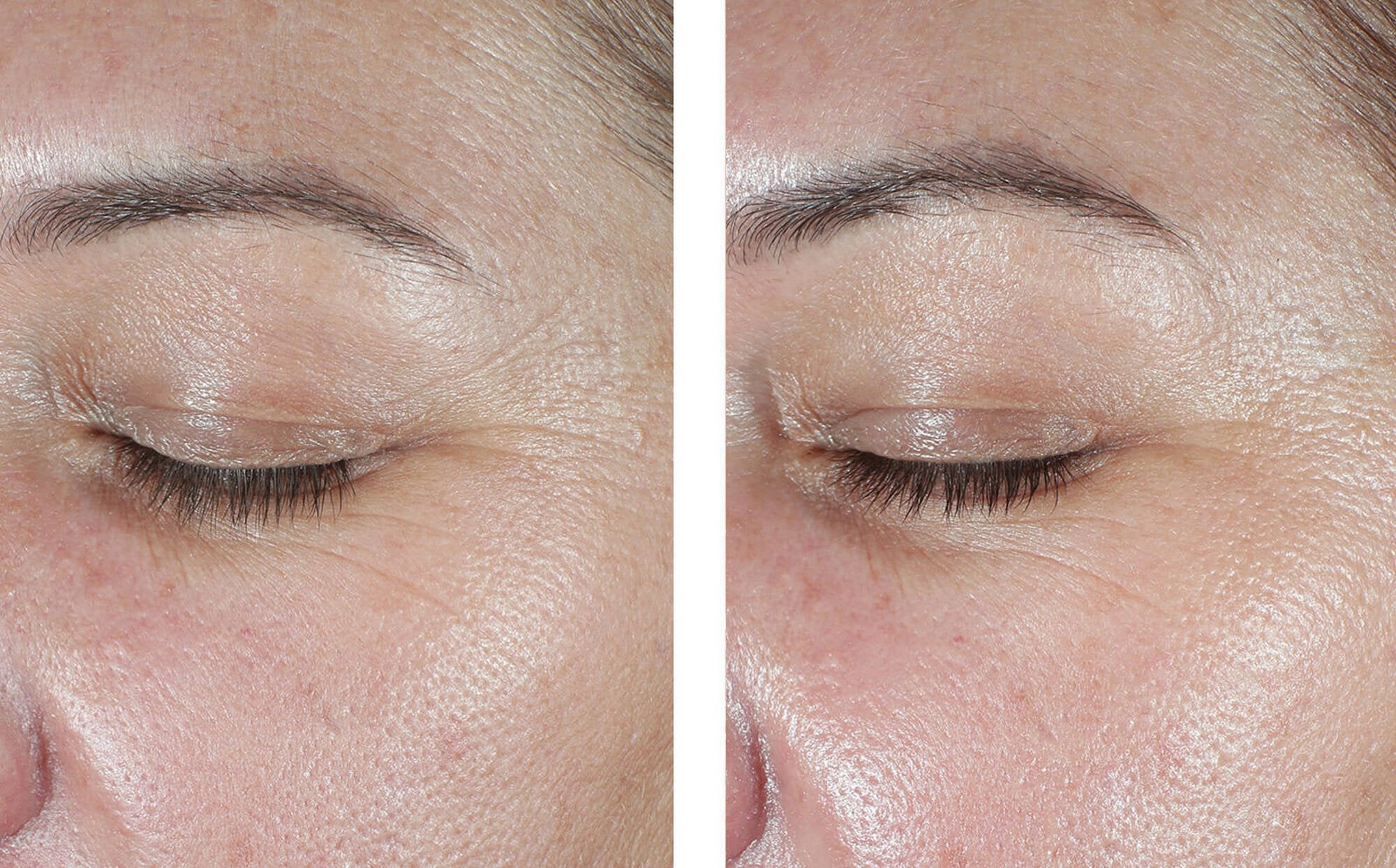 SkinBetter Science EyeMax Alpharet Overnight Cream