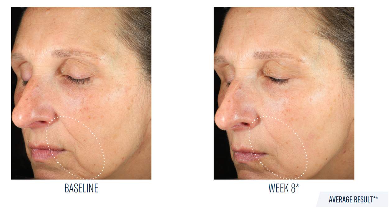 SkinBetter Science Mystro Revive Renewing Serum