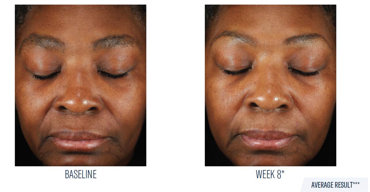 SkinBetter Science Mystro Revive Renewing Serum