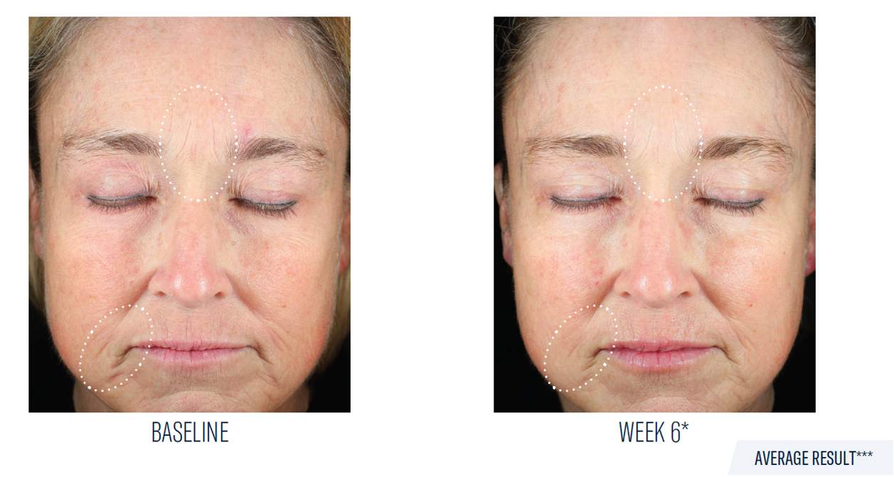 SkinBetter Science Mystro Revive Renewing Serum