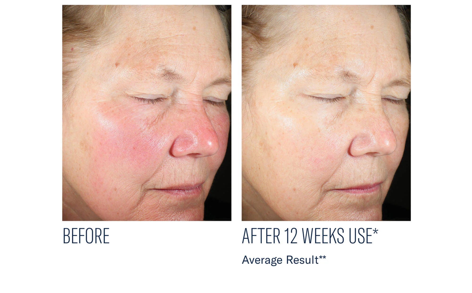 SkinBetter Science Even Intensive Skin Tone Correcting Serum