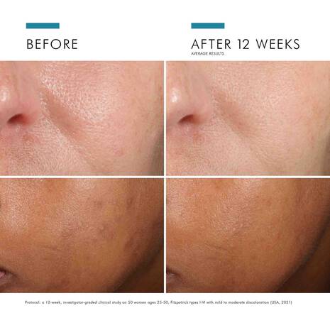 SkinCeuticals Phloretin CF