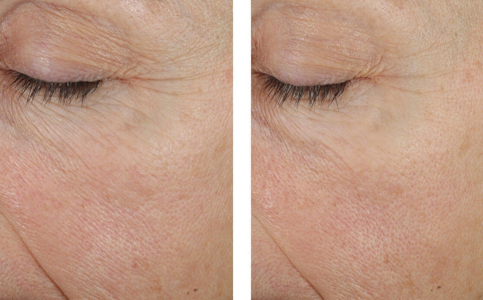 SkinBetter Science Trio Rebalancing Moisture Treatment