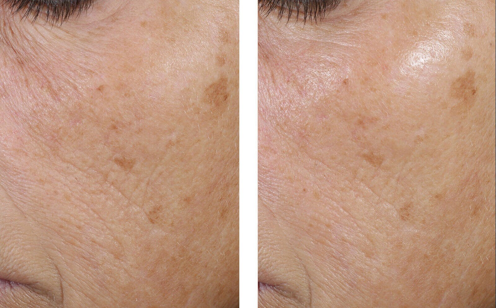 SkinBetter Science Trio Rebalancing Moisture Treatment