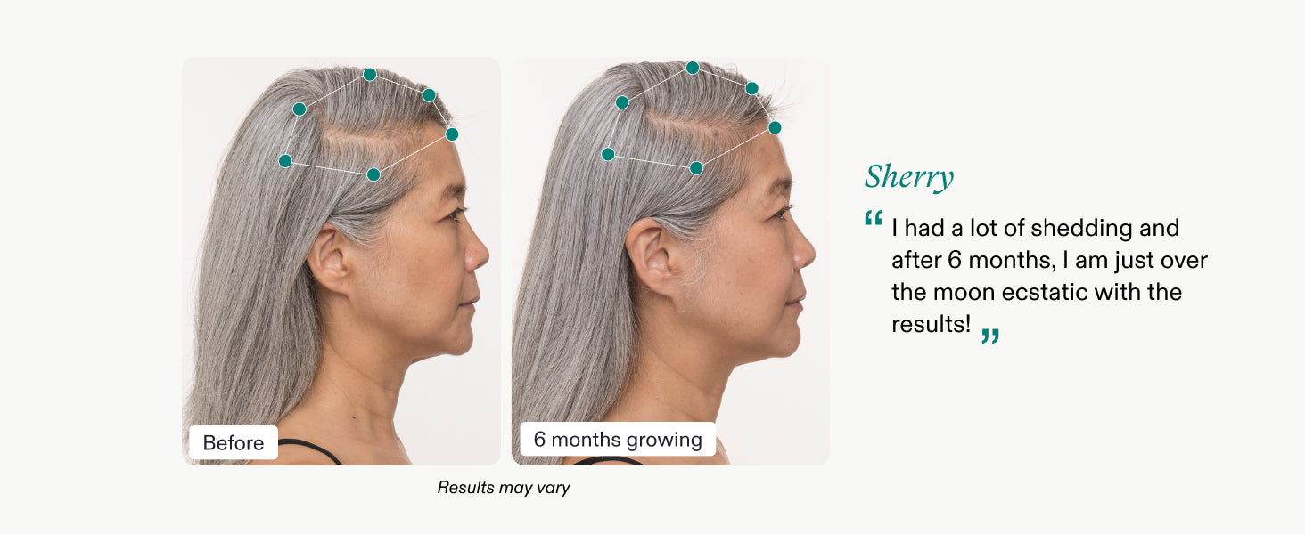 Nutrafol Women's Balance Hair Growth Supplements