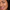 Smiling woman with natural hyperpigmentation across her cheek