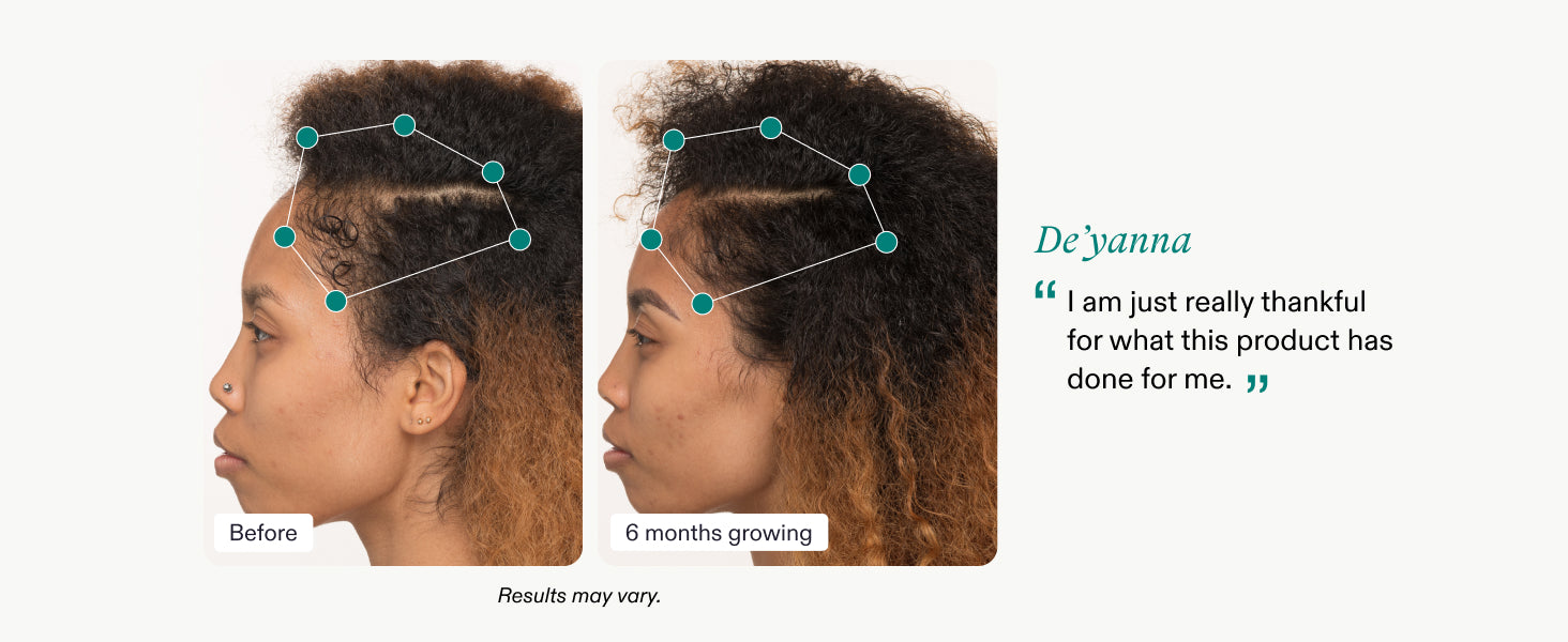 Nutrafol Postpartum Hair Growth Supplements