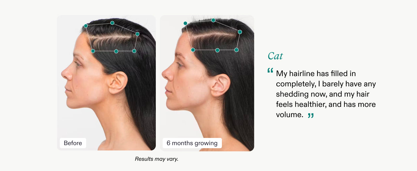 Nutrafol, compléments alimentaires végétaliens pour la croissance des cheveux chez les femmes