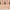Obagi clinical study photo of ELASTIderm Neck and Décolleté Lifting Concentrate: neck at baseline and after 12 weeks of use