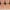 Obagi clinical study photo of ELASTIderm Neck and Décolleté Lifting Concentrate: second participant's neck at baseline and after 12 weeks of use