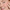 Smiling freckled woman applying soothing gel to a flushed cheek