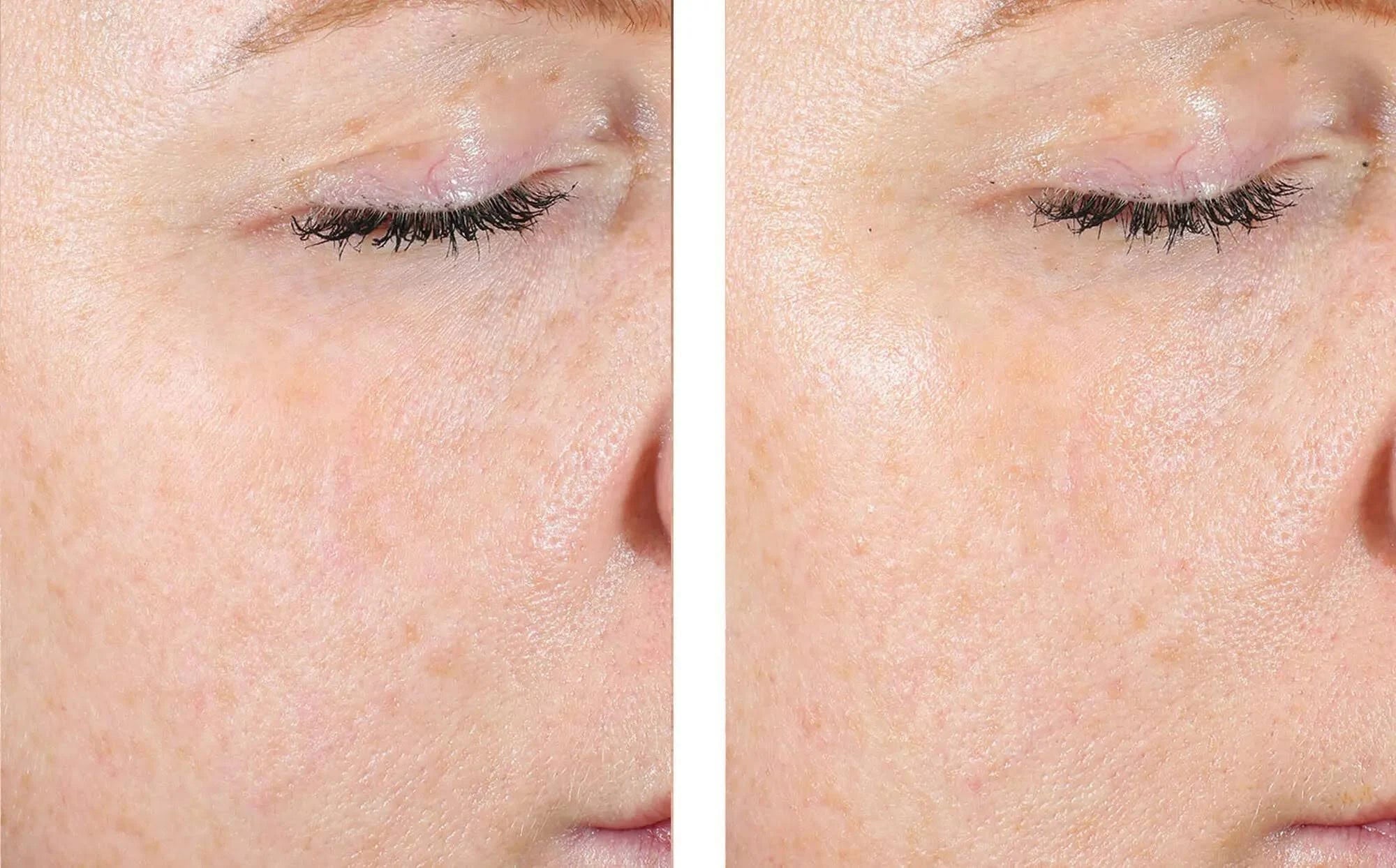 SkinBetter Science AlphaRet Exfoliating Peel Pads