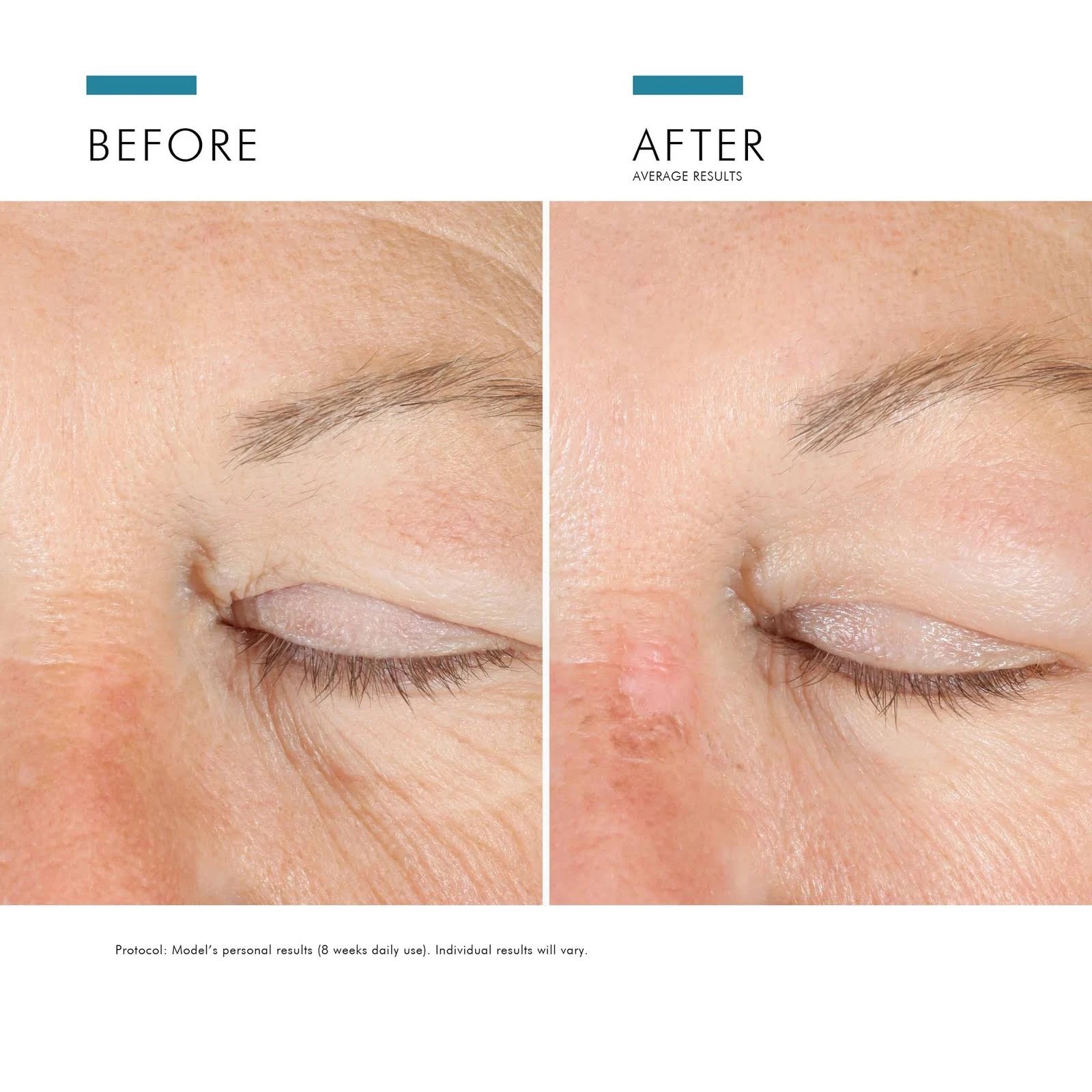 SkinCeuticals A.G.E. Advanced Eye