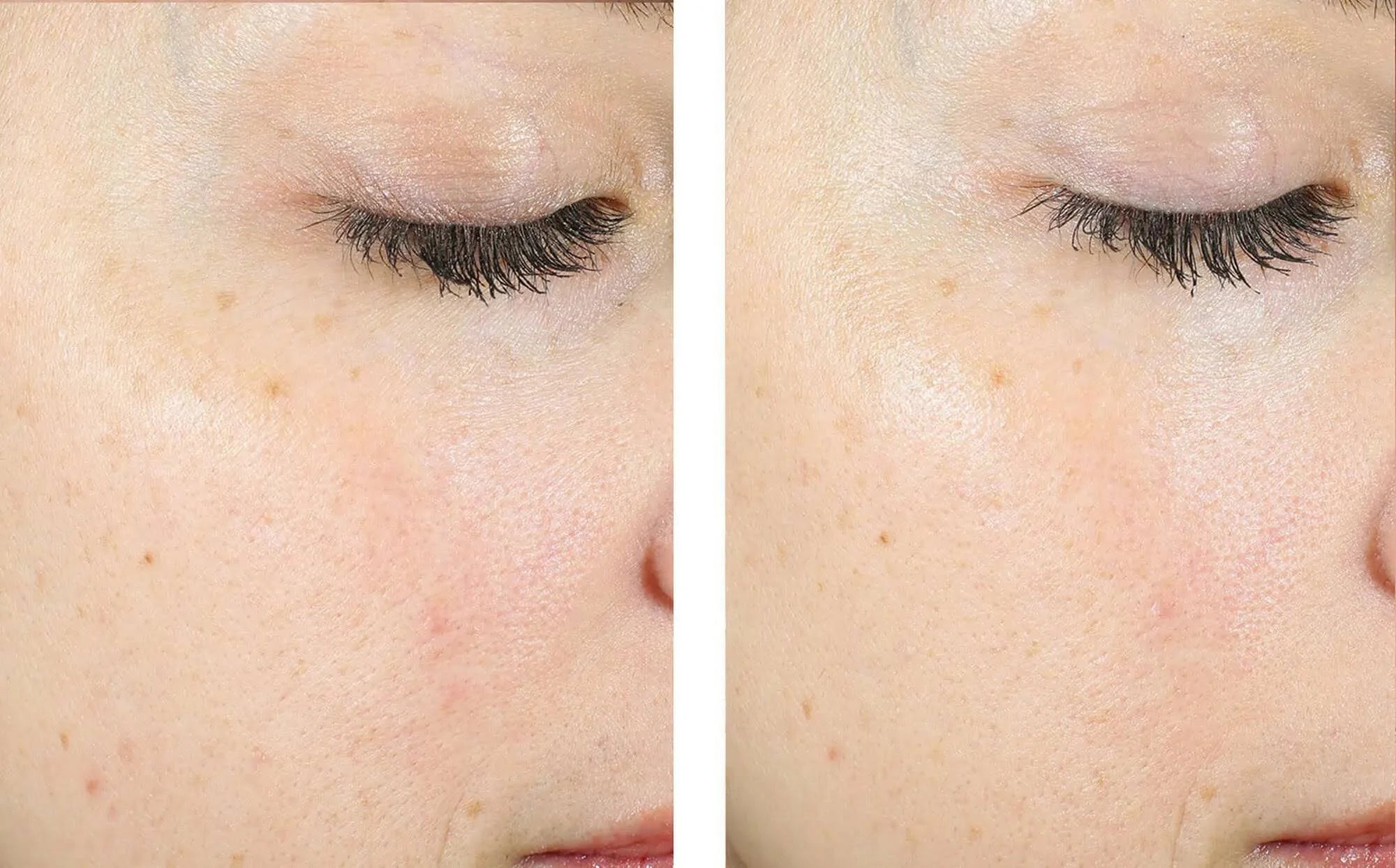 SkinBetter Science AlphaRet Exfoliating Peel Pads