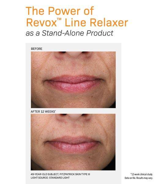 Revision Skincare Revox Line Relaxer - ELLEMES Medical Spa